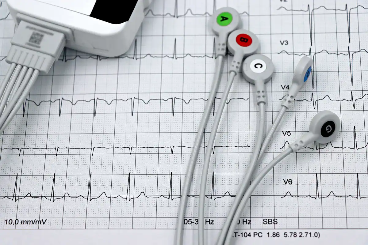 Electrozi de monitorizare așezați pe o electrocardiogramă tipărită