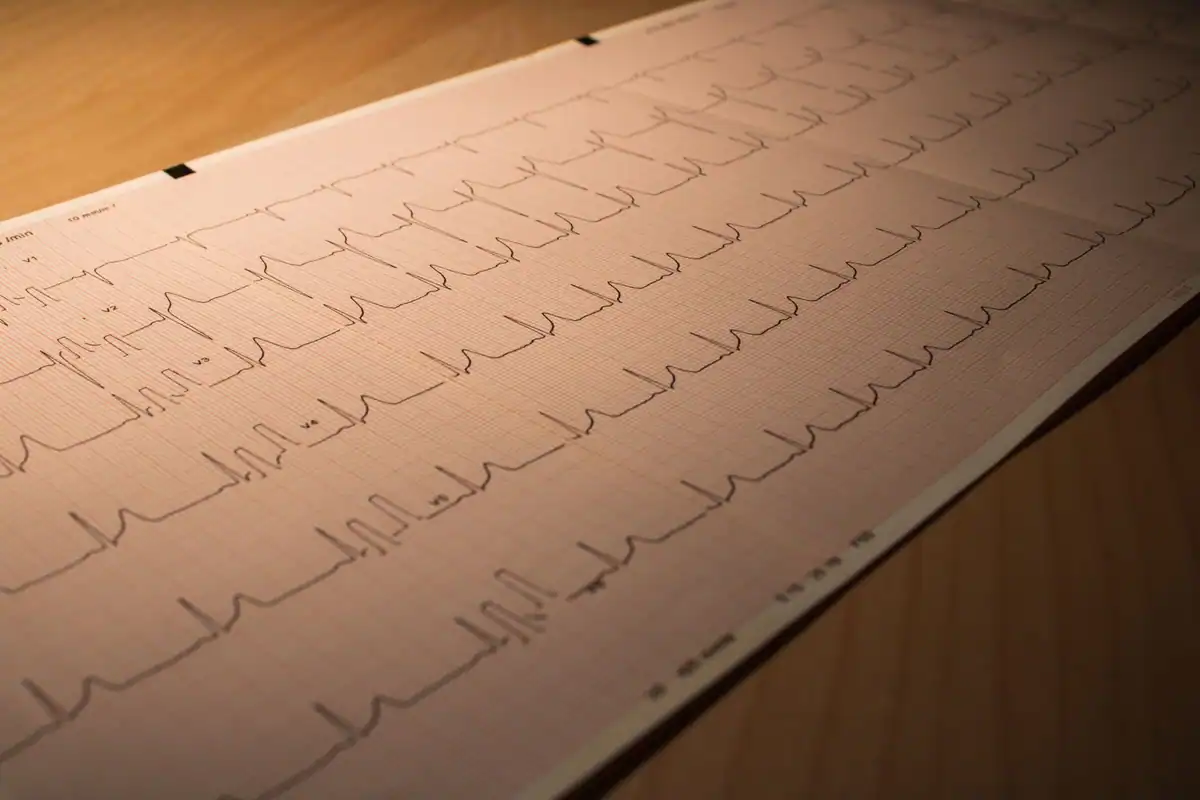 Traseu EKG tipărit cu activitatea electrică a inimii, pe o suprafață de lemn